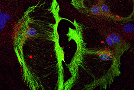 Microscopic photograph of nervous system cells.