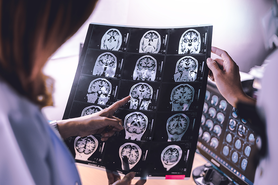 neurology-scan